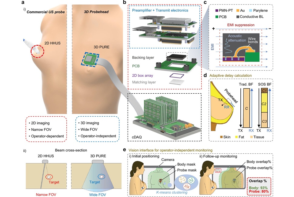 Imagen: Descripción general del ultrasonido portátil 3D para examen en tiempo real (Nayeem, M.O.G., Viswanath, S., Yoon, H. et al. Nature Communications (2026. https://doi.org/10.1038/s41467-026-74708-3)